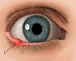 Лечение придаточного аппарата глаза